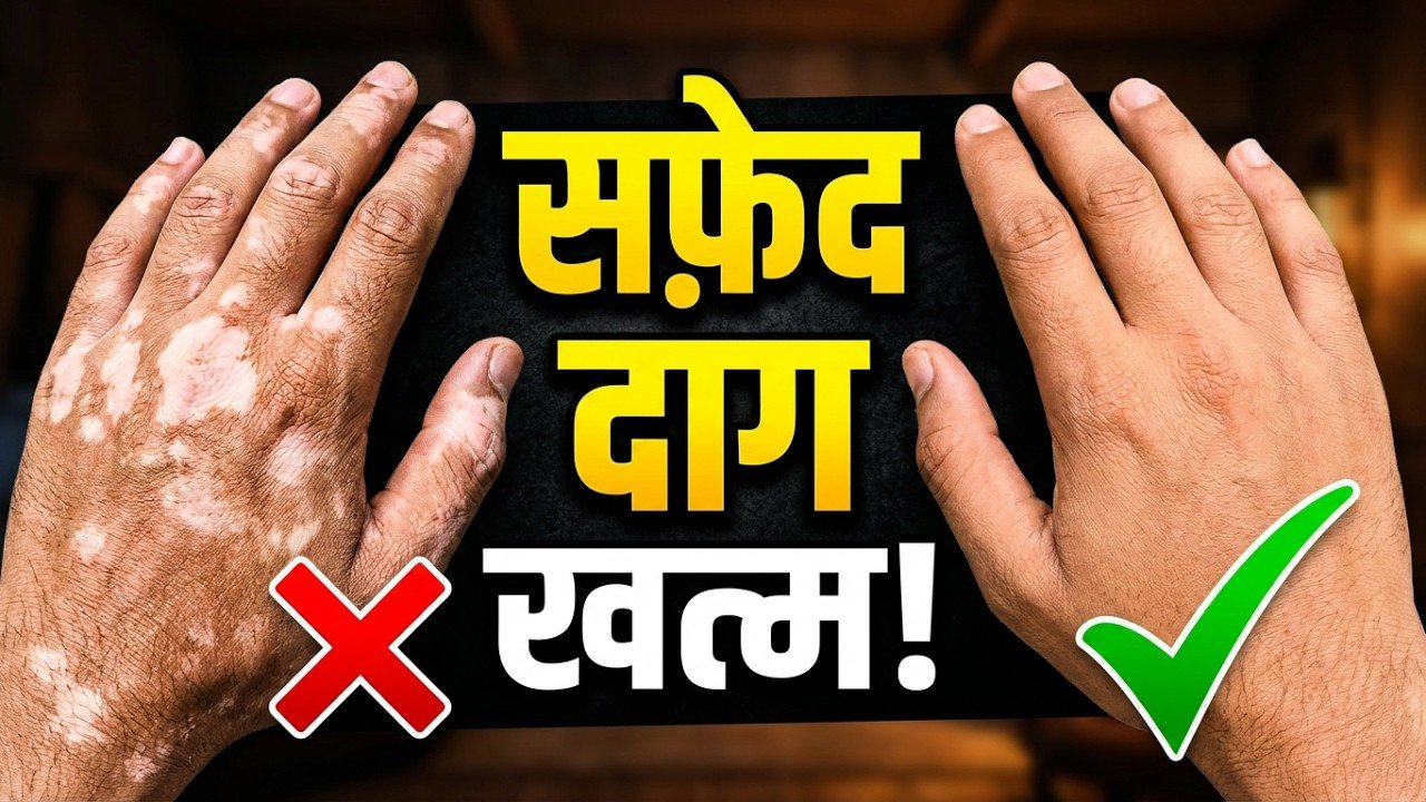 चाहे 40 साल पूराना ही सफ़ेद दाग क्यों ना हो, ये अद्भुत सप्त तेल उम्मीद की आखिरी किरण है, जरूर पढ़े और शेयर करे
