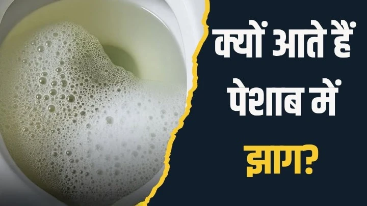 पेशाब में झाग आने का क्या मतलब होता है? आयुर्वेदिक न्यूट्रिशनिस्ट ने बताया क्या करें और कैसे दूर होगी दिक्कत पेशाब में झाग आने का क्या मतलब होता है? आयुर्वेदिक न्यूट्रिशनिस्ट ने बताया क्या करें और कैसे दूर होगी दिक्कत