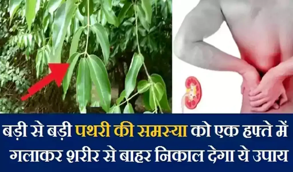 बड़ी से बड़ी पथरी की समस्या को एक हफ्ते में गलाकर शरीर से बाहर निकाल देगा ये चमत्कारी उपाय, शेयर जरूर करें