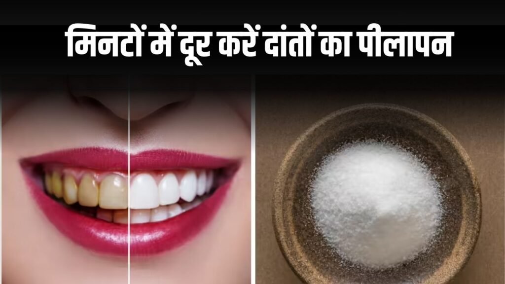 दांतों का पीलापन दूर करें, आयुर्वेदिक तरीके से फिटकरी से पाएं झटपट सफाई, जानें तरीका दांतों का पीलापन दूर करें, आयुर्वेदिक तरीके से फिटकरी से पाएं झटपट सफाई, जानें तरीका