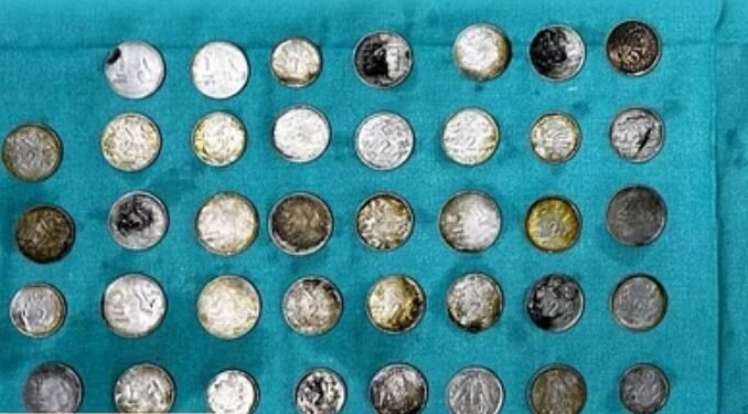 26 साल के युवक के पेट से निकले 39 सिक्के और 37 चुंबक के टुकड़े पेट में दर्द के बाद लाया गया था अस्पताल 26 साल के युवक के पेट से निकले 39 सिक्के और 37 चुंबक के टुकड़े पेट में दर्द के बाद लाया गया था अस्पताल