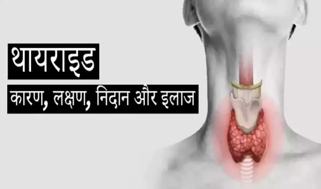 थाइराइड का सबसे आसान अचूक उपाय जो सिर्फ 15 दिनों में अद्भुत परिणाम देगा, जरूर अपनाएँ और शेयर करे