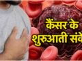 अगर कैंसर होने से पहले हो जाये सचेत तो इस भयावह रोग से हमेशा के लिए मिल सकता है छुटकारा