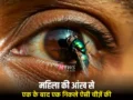 इस महिला की आंख से एक के बाद एक निकले ऐसी चीज़ें की डॉक्टर भी रह गए दंग, आप भी ध्यान दें​