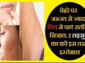 चेहरे पर जरूरत से ज्यादा तिल से पाएं रातों रात निजात, 2 लहसुन का करें इस तरह इस्तेमाल