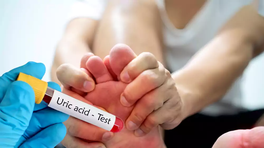 uric acid
